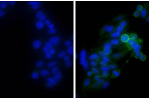 Human epithelial carcinoma cell line HEp-2 was stained with Mouse Anti-Human CD44-UNLB, and DAPI. (山羊 anti-小鼠 Ig Antibody (Biotin) - Preadsorbed)