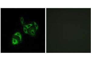 Immunofluorescence analysis of A549 cells, using SLC27A4 antibody. (SLC27A4 抗体  (N-Term))
