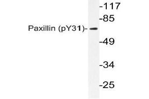 Western blot (WB) analyzes of p-Paxillin (pTyr31) antibody in extracts from HeLa TNF cells. (Paxillin 抗体  (pTyr31))