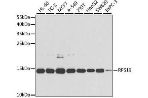 Western blot analysis of extracts of various cell lines, using RPS19 antibody. (RPS19 抗体  (AA 1-145))