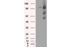 HEK293T cells were transfected with the pCMV6-ENTRY control (Left lane) or pCMV6-ENTRY BUB1B (Right lane) cDNA for 48 hrs and lysed. (BUB1B 抗体)