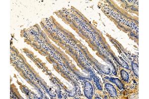 ABIN7096111 and ABIN7100173 at 1/100 staining rat colorectal tissue by IHC-P. (Leiomodin 2 抗体)