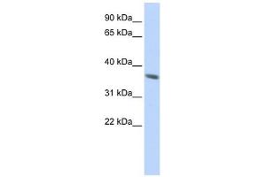Cytokeratin 222 Pseudogene antibody used at 1 ug/ml to detect target protein. (KRT222 抗体  (N-Term))