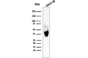 Western Blot Analysis of COLO-38 cell lysate using gp100 Rabbit Polyclonal Antibody (Melanoma gp100 抗体)