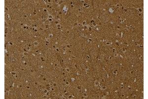 ABIN6254871 and ABIN6274016 at 1/100 staining Rat brain tissue by IHC-P. (Histone H2A 抗体  (acLys9))