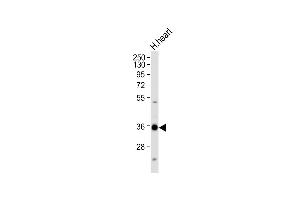 Anti-Mouse Nkx2-5 Antibody (Center) at 1:1000 dilution + Human heart tissue lysate Lysates/proteins at 20 μg per lane.