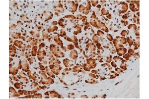 Immunohistochemistry (IHC) image for anti-Activating Transcription Factor 2 (ATF2) (pThr51), (pThr69) antibody (ABIN6256594)