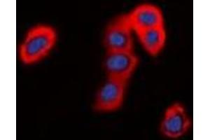Immunofluorescent analysis of TMEM16J staining in HepG2 cells. (ANO9 抗体)
