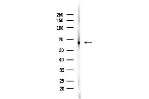 anti-Hepatic and Glial Cell Adhesion Molecule (HEPACAM) (C-Term) antibody