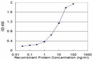 Detection limit for recombinant GST tagged CALCR is approximately 0. (Calcitonin Receptor 抗体  (AA 394-474))