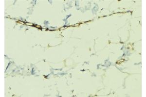 ABIN6268970 at 1/100 staining Human lung tissue by IHC-P. (Dematin 抗体  (pSer403))