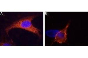 Immunocytochemistry (ICC) image for anti-Transient Receptor Potential Cation Channel, Subfamily M, Member 8 (TRPM8) (AA 917-929), (Extracellular) antibody (ABIN7043837)