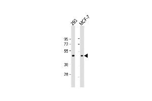 All lanes : Anti-RARB Antibody (Center) at 1:1000 dilution Lane 1: 293 whole cell lysate Lane 2: MCF-7 whole cell lysate Lysates/proteins at 20 μg per lane. (Retinoic Acid Receptor beta 抗体  (AA 160-188))