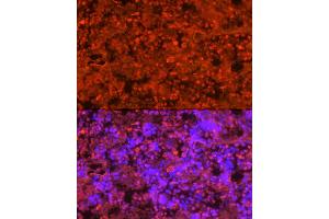 Immunofluorescence analysis of rat bone marrow cells using Neutrophil Elastase (ELANE) Rabbit pAb (ABIN6131604, ABIN6140110, ABIN6140111 and ABIN6216843) at dilution of 1:250 (40x lens). (ELANE 抗体  (AA 30-267))