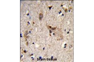 Formalin-fixed and paraffin-embedded human brain tissue reacted with ALDH18A1 Antibody , which was peroxidase-conjugated to the secondary antibody, followed by DAB staining. (P5CS 抗体  (AA 176-205))