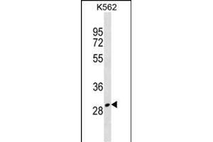 ZN Antibody (Center) (ABIN1538456 and ABIN2838223) western blot analysis in K562 cell line lysates (35 μg/lane). (ZNF365 抗体  (AA 50-77))