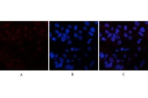Immunofluorescence analysis of human liver cancer tissue.