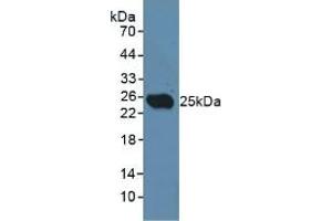 Detection of CD301 in Rat Testis Tissue using Polyclonal Antibody to Cluster Of differentiation 301 (CD301) (CLEC10A 抗体  (AA 71-239))