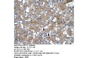 Human Liver (ZNF81 抗体  (Middle Region))