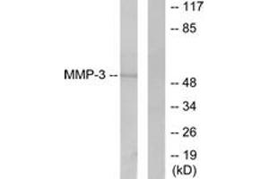 Western blot analysis of extracts from 293 cells, using MMP-3 Antibody. (MMP3 抗体  (AA 421-470))