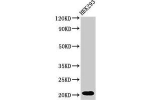 Western Blot Positive WB detected in: HEK293 whole cell lysate All lanes: RPS10P5 antibody at 2 μg/mL Secondary Goat polyclonal to rabbit IgG at 1/50000 dilution Predicted band size: 21 kDa Observed band size: 21 kDa (RPS10P5 抗体)