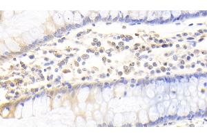 Immunohistochemistry (IHC) image for anti-Carcinoembryonic Antigen-Related Cell Adhesion Molecule 1 (CEACAM1) antibody (ABIN7435280)