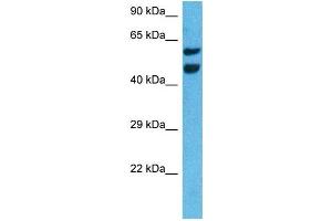 Host:  Rat  Target Name:  NR4A3  Sample Tissue:  Rat Liver  Antibody Dilution:  1ug/ml (NR4A3 抗体  (Middle Region))