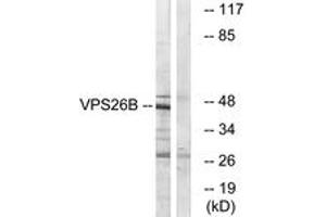 Western blot analysis of extracts from LOVO cells, using VPS26B Antibody. (VPS26B 抗体  (AA 231-280))