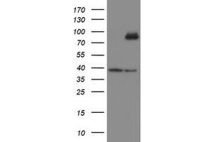 Image no. 6 for anti-SKI-Like Oncogene (SKIL) (AA 307-684) antibody (ABIN1491380)