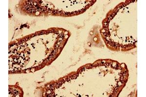 Immunohistochemistry (IHC) image for anti-LPS-Responsive Vesicle Trafficking, Beach and Anchor Containing (LRBA) (AA 2-252) antibody (ABIN7158439)
