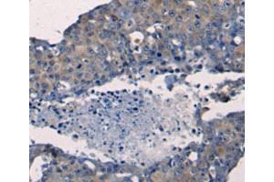 Immunohistochemistry (IHC) image for anti-Fibroblast Growth Factor 2 (Basic) (FGF2) antibody (ABIN2425614) (FGF2 抗体)