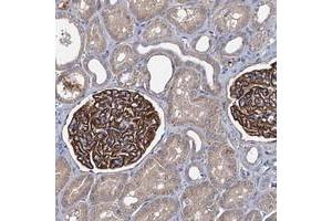 Immunohistochemical staining of human kidney with LRRC18 polyclonal antibody  shows distinct positivity in cells in glomeruli. (LRRC18 抗体)