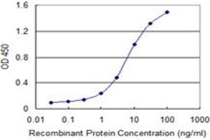 Detection limit for recombinant GST tagged FUBP1 is 0. (FUBP1 抗体  (AA 1-653))