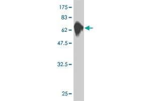 Western Blot detection against Immunogen (76. (MKNK1 抗体  (AA 1-465))