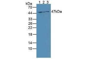 Western blot analysis of (1) Human MCF-7 Cells, (2) Human SGC7901 Cells and (3) Human HeLa cells. (Cytokeratin 18 抗体  (AA 72-380))