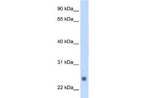 WB Suggested Anti-TNNI2 Antibody Titration:  1. (TNNI2 抗体  (N-Term))