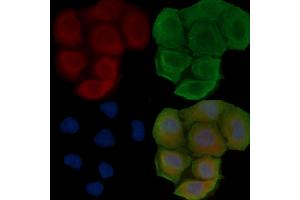 ABIN6257755 and ABIN6273649 staining Hela cells(30 min of UV treatment) by IF/ICC.