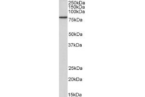 Biotinylated ABIN5539926 (2µg/ml) staining of A431 lysate (35µg protein in RIPA buffer), exactly mirroring its parental non-biotinylated product. (JUP 抗体  (C-Term) (Biotin))