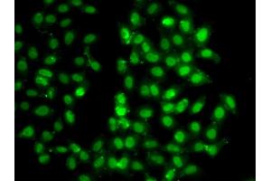 Immunofluorescence analysis of U2OS cells using PSMD8 antibody.