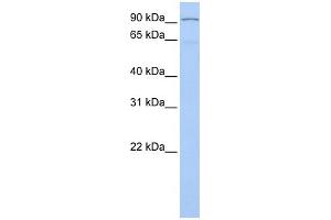 WB Suggested Anti-LZTR1 Antibody Titration:  0. (LZTR1 抗体  (N-Term))