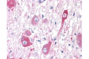 Anti-GRM5 / MGLUR5 antibody IHC of human brain, neurons and glia.