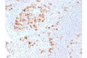 Formalin-fixed, paraffin-embedded human Tonsil stained with Kappa Light Chain Rabbit Recombinant Monoclonal (KLC2289R). (Recombinant IGKC 抗体)