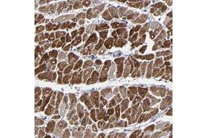 Immunohistochemical staining of human heart muscle with ZNF175 polyclonal antibody  shows strong cytoplasmic positivity in myocytes . (ZNF175 抗体)