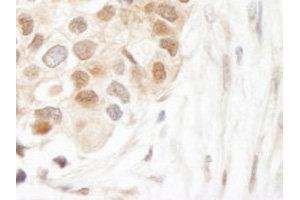 Immunohistochemistry (IHC) image for anti-Ubiquitin C (UBC) (AA 1-100) antibody (ABIN1683190) (UBC 抗体  (AA 1-100))