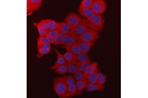 anti-Fatty Acid Synthase (FASN) (AA 1-226) antibody
