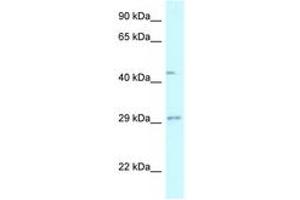 Image no. 1 for anti-Fucosyltransferase 8 (Alpha (1,6) Fucosyltransferase) (FUT8) (AA 27-76) antibody (ABIN6747582) (FUT8 抗体  (AA 27-76))