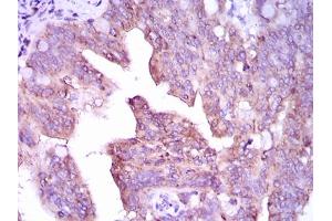 Image no. 1 for anti-Calcium/calmodulin-Dependent Protein Kinase IV (CAMK4) antibody (ABIN1491438) (CAMK4 抗体)