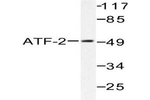 Image no. 2 for anti-Activating Transcription Factor 2 (ATF2) antibody (ABIN265319) (ATF2 抗体)