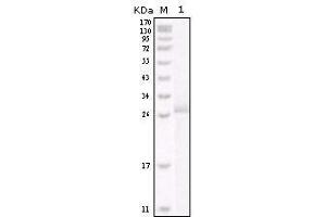 Western blot analysis using ERBB2 mouse mAb against truncated ERBB2 recombinant protein. (ErbB2/Her2 抗体  (AA 750-987))