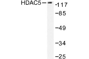 Image no. 1 for anti-Histone Deacetylase 5 (HDAC5) antibody (ABIN265456) (HDAC5 抗体)
